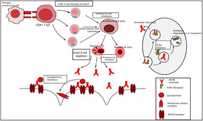 Novel Treatments in Myasthenia Gravis